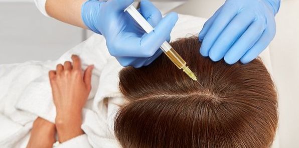 Мезотерапия для волос: тайна красоты и здоровья в каждой пряди